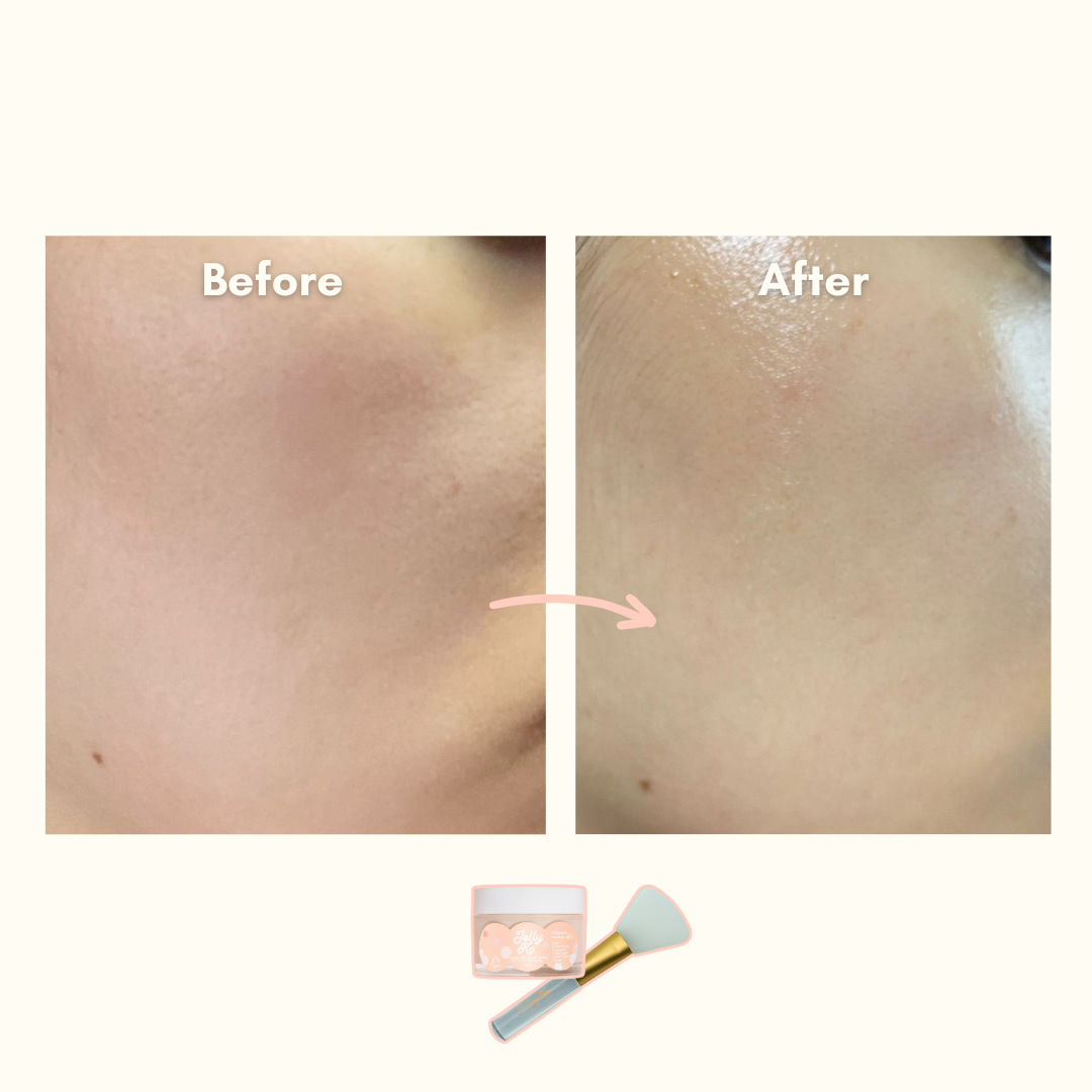 Before & After using K-Beauty Beginner Set