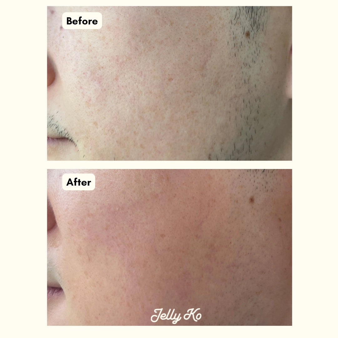 Jelly Ko Glowy Skin Duo