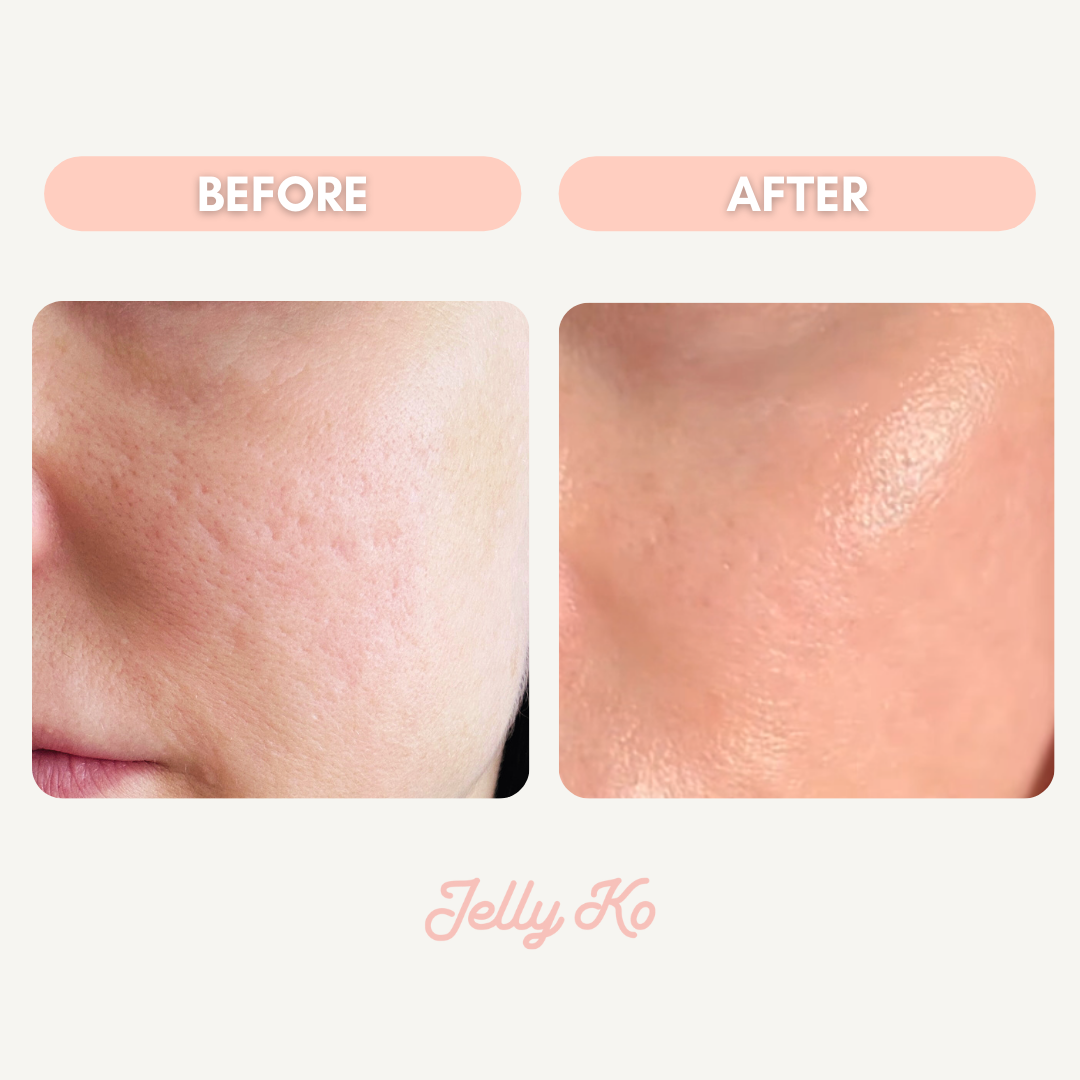 Dewy Glaze Toner Before and After