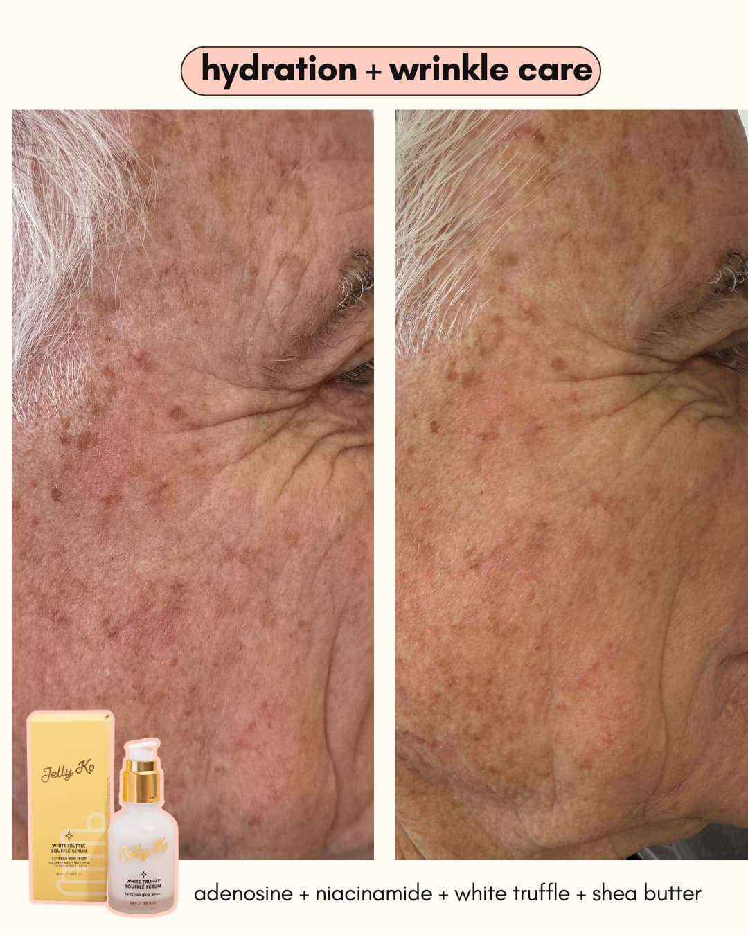 White Truffle Souffle Serum Results