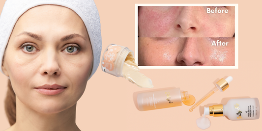 Best Korean Beauty for Perimenopausal Skin