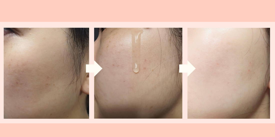 How to Layer Korean Serums Like a Pro