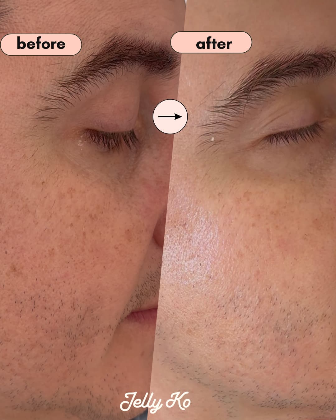 Dewy Skin Trio Results