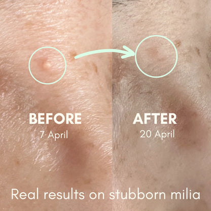 Be Jelly Before & After Serum