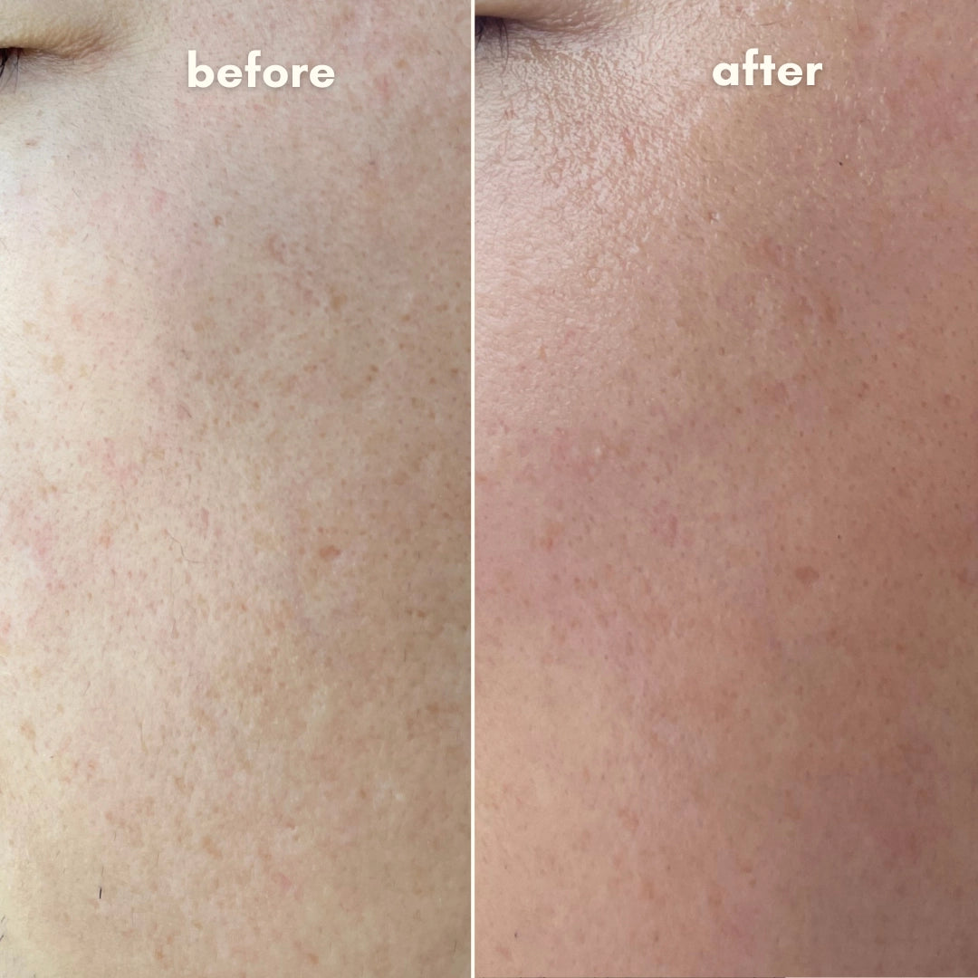 Before & After Dewy Glaze Toner