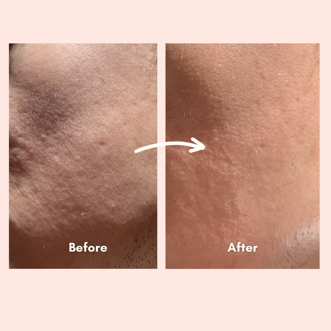 Cherry Blossom Sleeping Mask Before & After