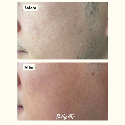 Jelly Ko Glowy Skin Duo