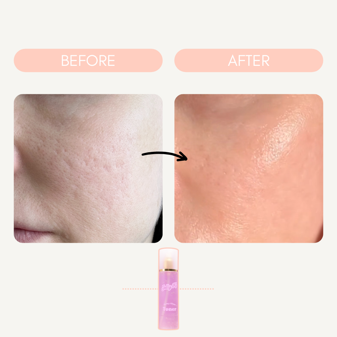 Before and After Dewy Glaze Toner