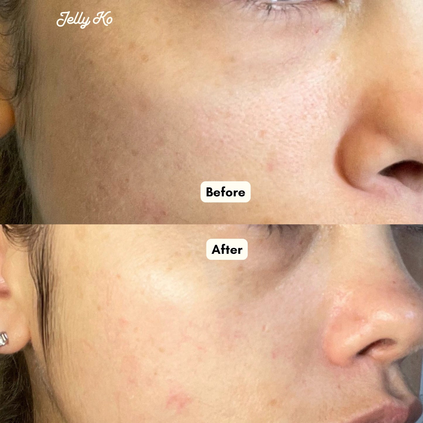 Dewy Skin Trio Results