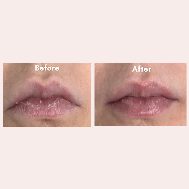 Jelly Ko Lip Treatment Duo Before and After